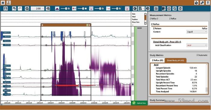 探頭視圖_20250214103238(1)